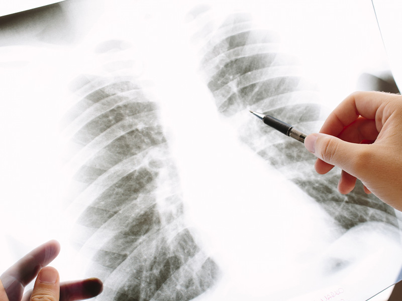 胸部・胃部X線検査